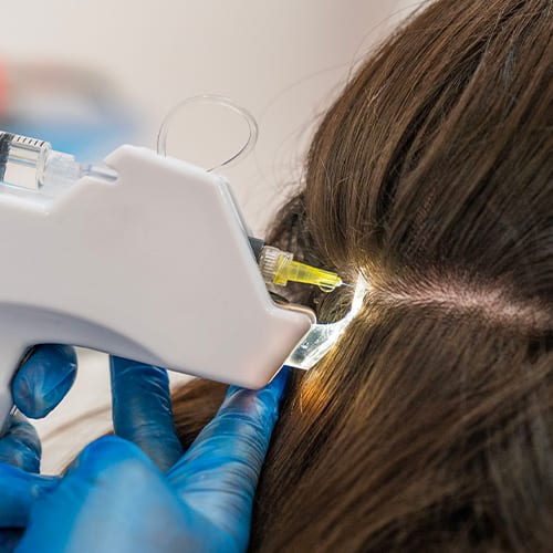 traitement capillaire mesotherapie cheveux soin esthetique greffe cheveux prix implant capillaire chirurgie esthetique institut flandrin paris