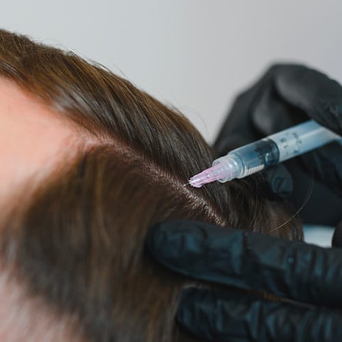 traitement capillaire mesotherapie cheveux soin esthetique greffe cheveux prix implant capillaire chirurgie esthetique paris institut flandrin