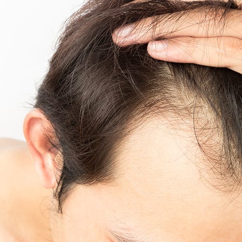 mesogreffe greffe cheveux paris chirurgie esthetique soin esthetique prp mesotherapie cheveux institut flandrin paris