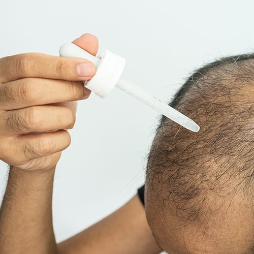 minoxidil greffe cheveux paris chirurgie esthetique soin esthetique prp mesotherapie cheveux institut flandrin paris